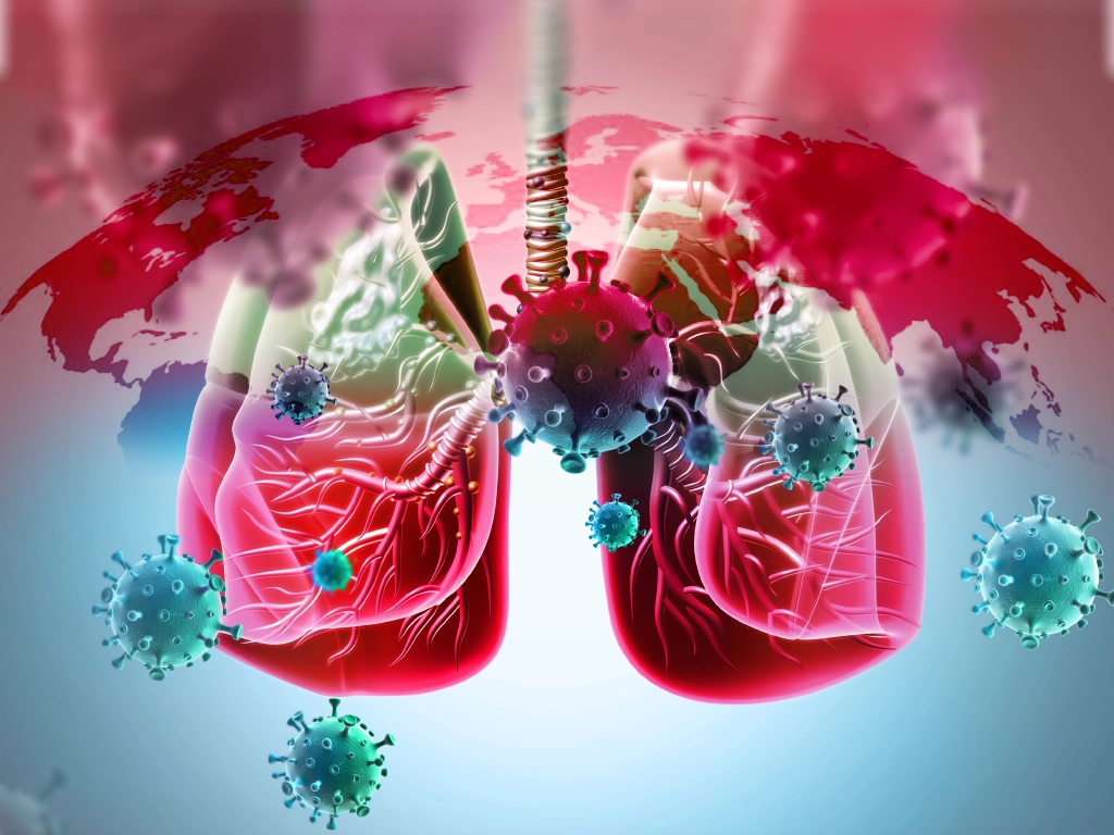 Advanced Air & Surface Purification Technology Blog - ActivePure Technology Illustration of human lungs infected with tuberculosis bacteria against a global outbreak backdrop, highlighting airborne transmission risks.